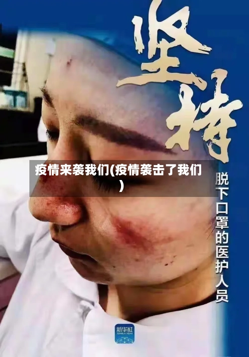 疫情来袭我们(疫情袭击了我们)-第1张图片